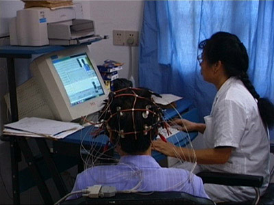 什么是癫痫病的影像学检查