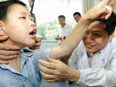 标准治疗儿童癫痫的方法分为几步