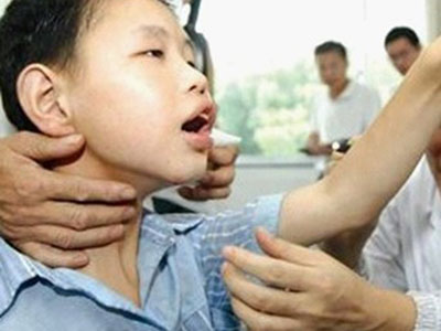 小儿癫痫的治疗方法